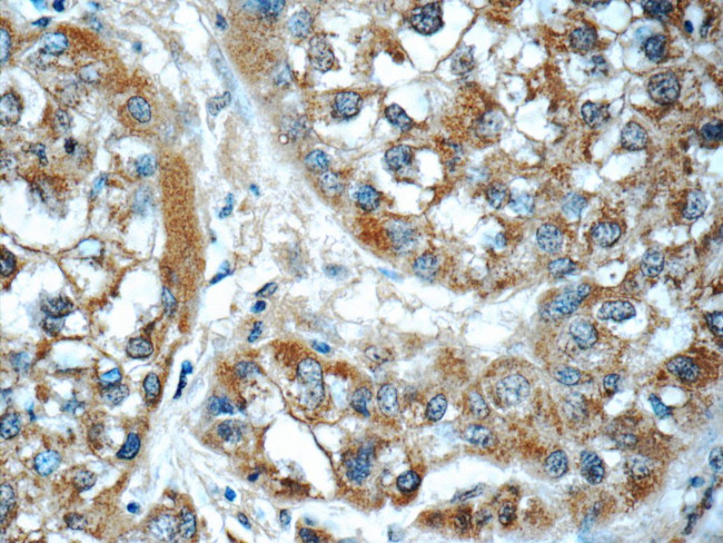 GSTO1 Antibody in Immunohistochemistry (Paraffin) (IHC (P))