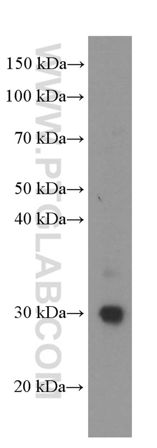 GSTO1 Antibody in Western Blot (WB)