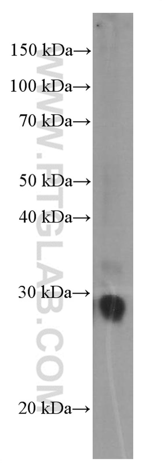 GSTO1 Antibody in Western Blot (WB)