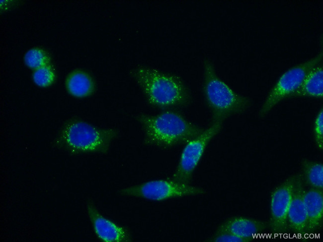 ABCD1 Antibody in Immunocytochemistry (ICC/IF)