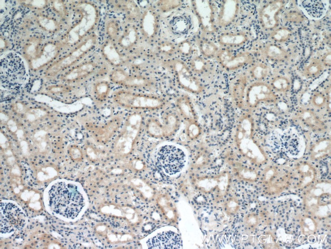 SMN Antibody in Immunohistochemistry (Paraffin) (IHC (P))