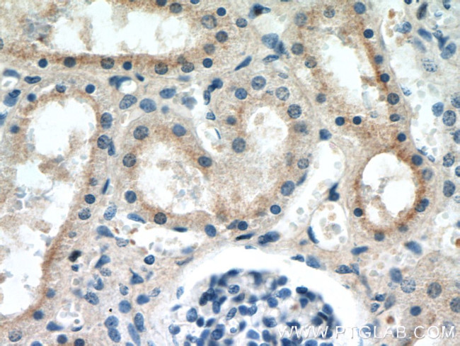 SMN Antibody in Immunohistochemistry (Paraffin) (IHC (P))