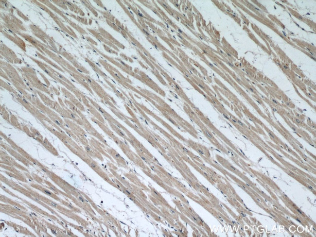 SMN Antibody in Immunohistochemistry (Paraffin) (IHC (P))