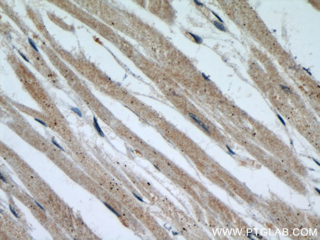 SMN Antibody in Immunohistochemistry (Paraffin) (IHC (P))