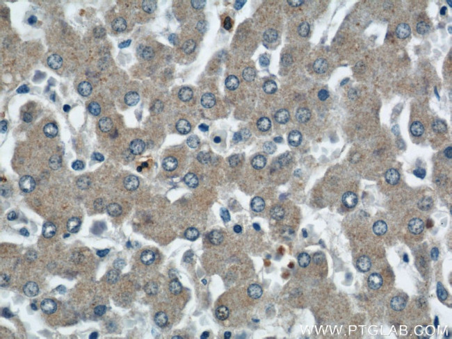 SMN Antibody in Immunohistochemistry (Paraffin) (IHC (P))