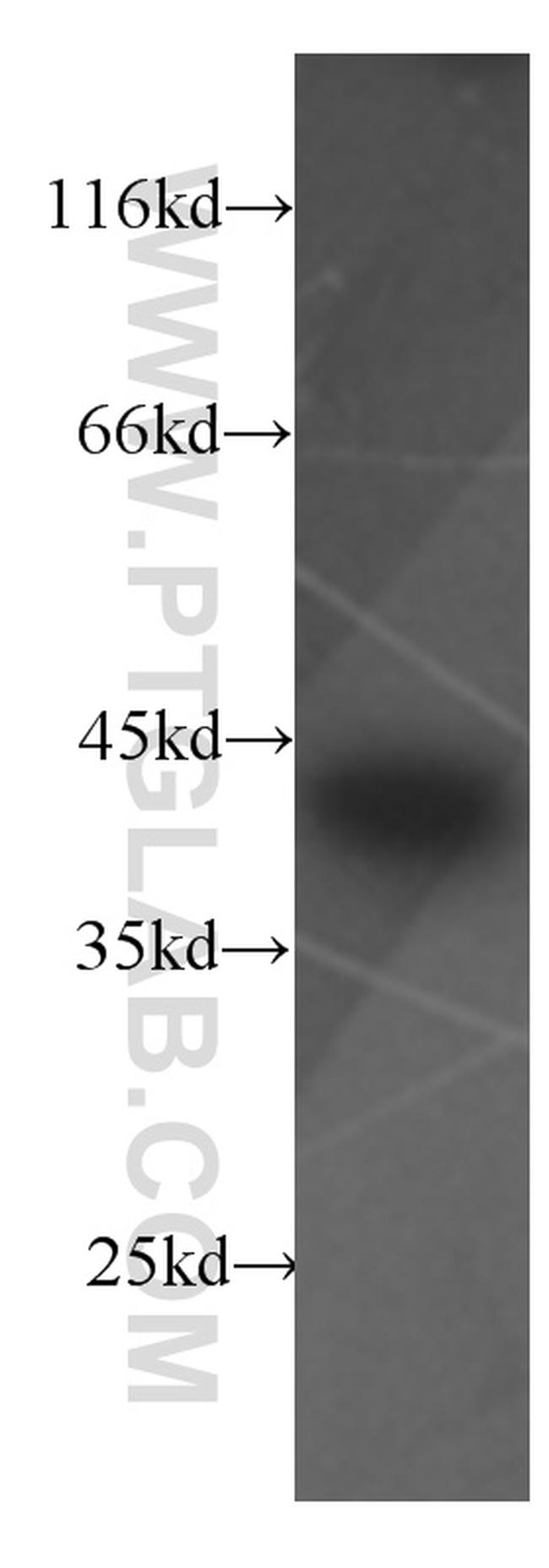 SMN Antibody in Western Blot (WB)