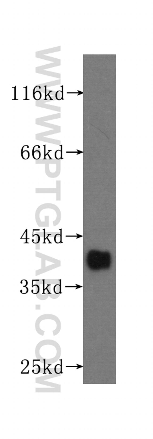 SMN Antibody in Western Blot (WB)