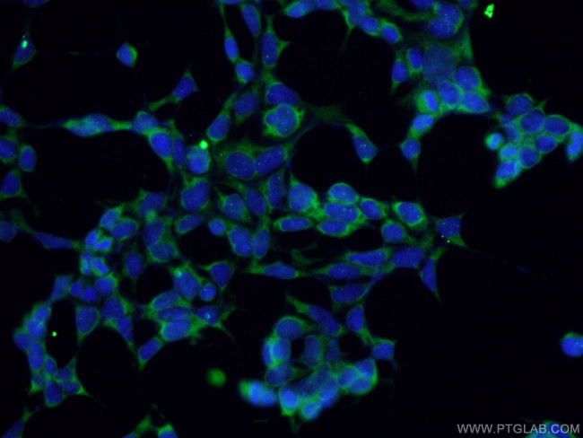 SMN Antibody in Immunocytochemistry (ICC/IF)