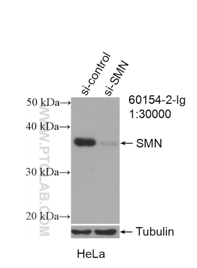 SMN Antibody in Western Blot (WB)