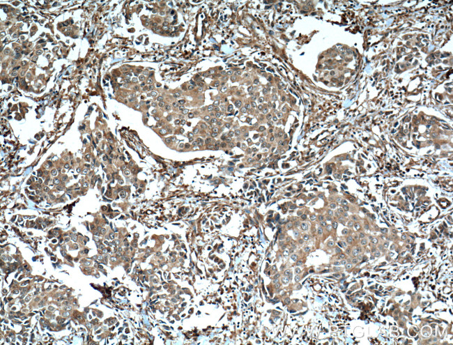 EPHA1 Antibody in Immunohistochemistry (Paraffin) (IHC (P))