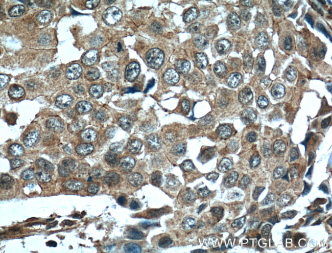 EPHA1 Antibody in Immunohistochemistry (Paraffin) (IHC (P))