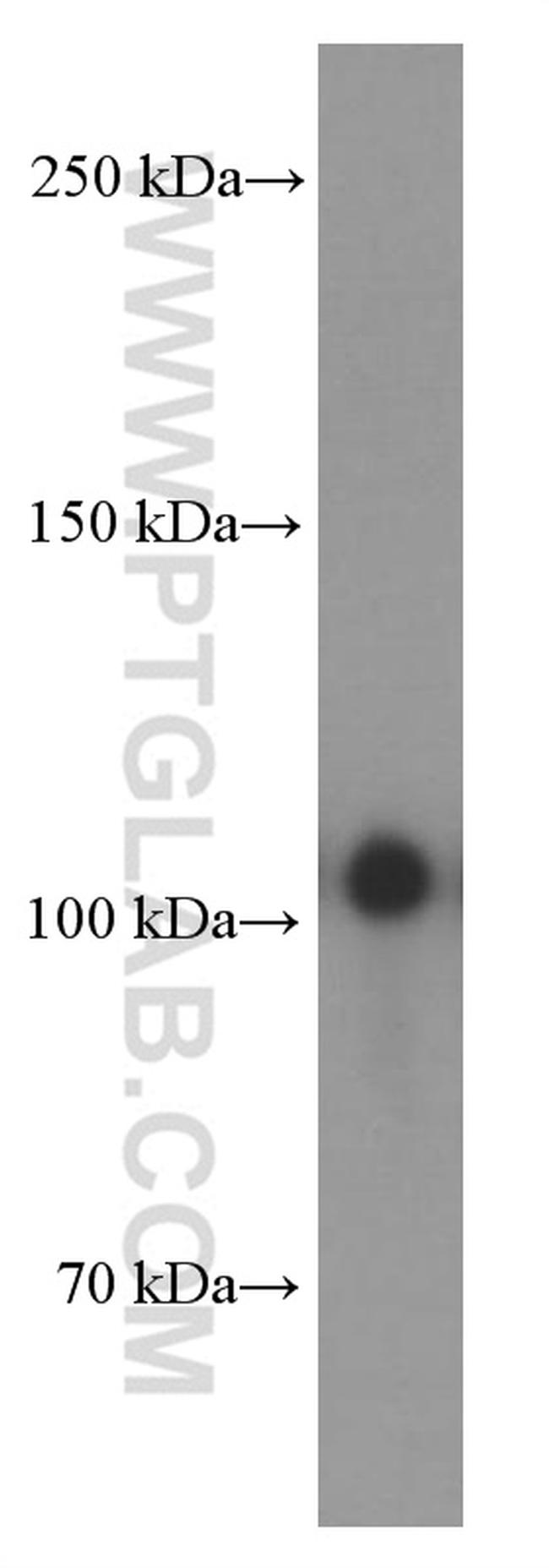 EPHA1 Antibody in Western Blot (WB)