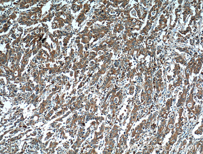 EPHA1 Antibody in Immunohistochemistry (Paraffin) (IHC (P))