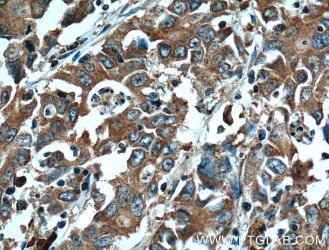 EPHA1 Antibody in Immunohistochemistry (Paraffin) (IHC (P))