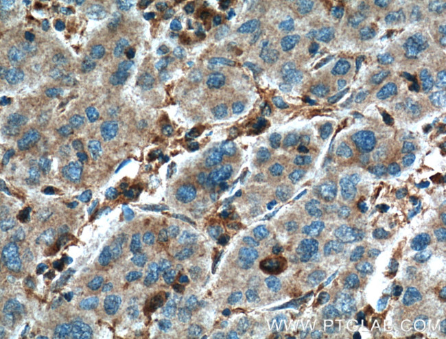 EPHA1 Antibody in Immunohistochemistry (Paraffin) (IHC (P))