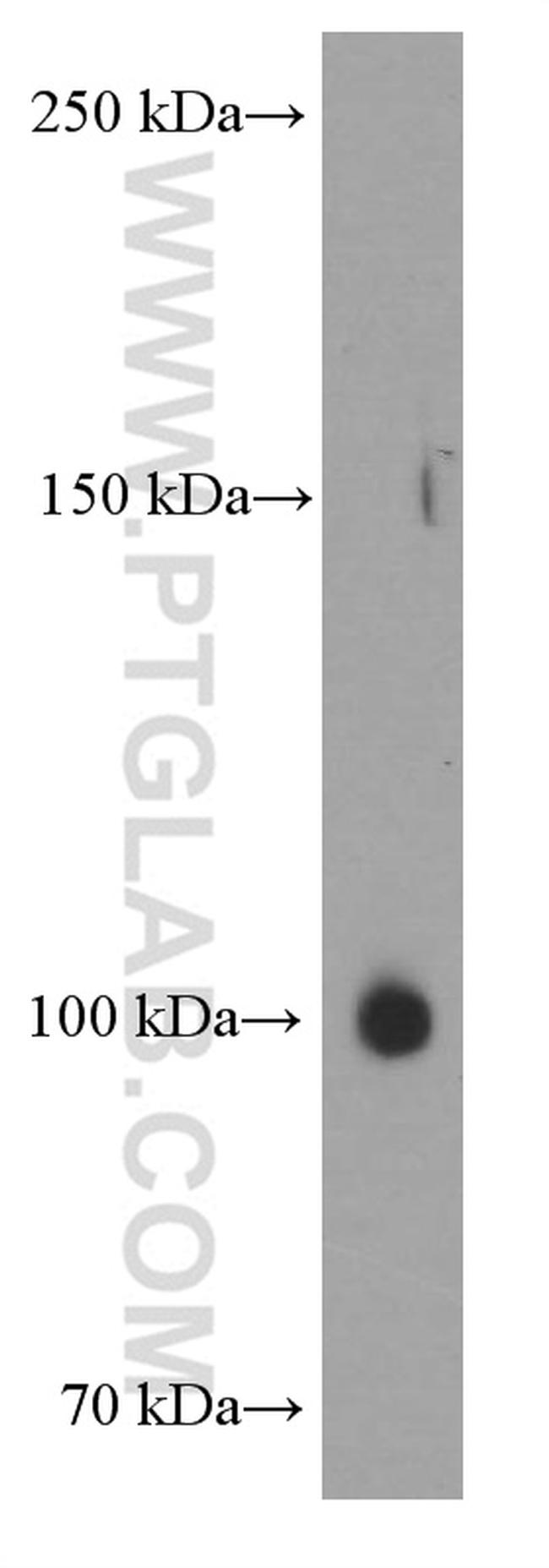 EPHA1 Antibody in Western Blot (WB)