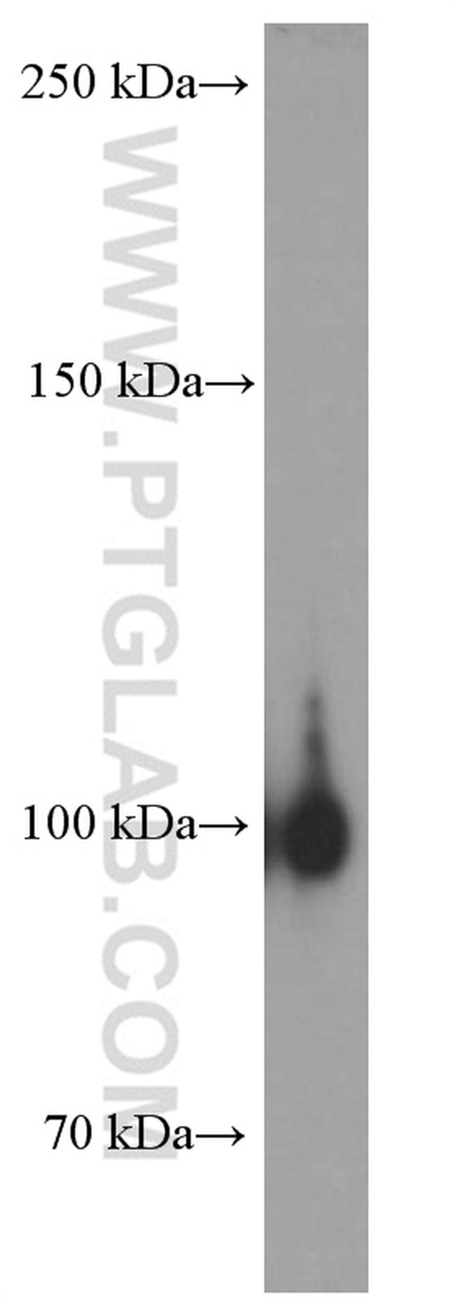 EPHA1 Antibody in Western Blot (WB)