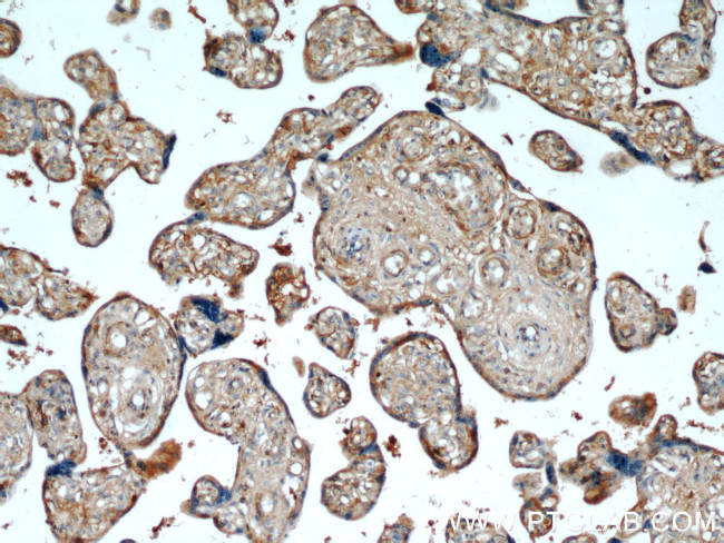 AMOT Antibody in Immunohistochemistry (Paraffin) (IHC (P))