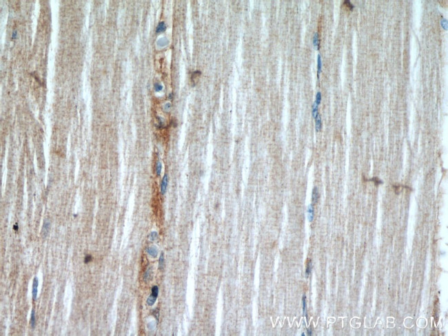 AMOT Antibody in Immunohistochemistry (Paraffin) (IHC (P))