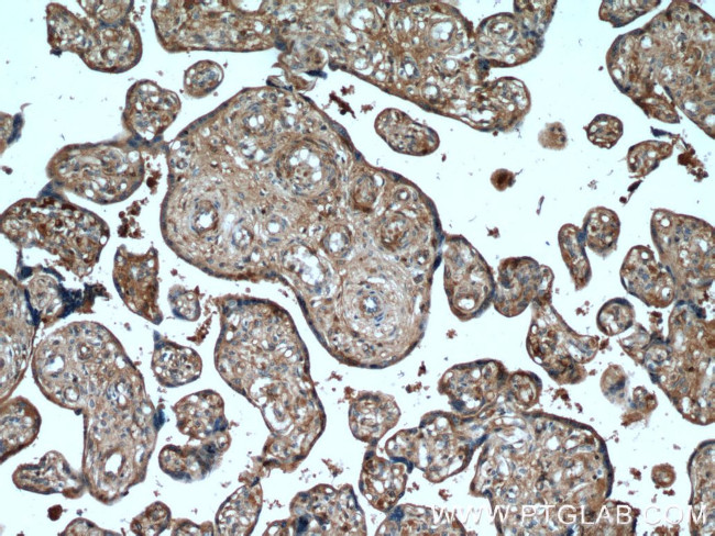 AMOT Antibody in Immunohistochemistry (Paraffin) (IHC (P))