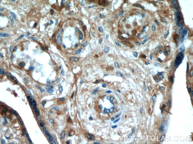 AMOT Antibody in Immunohistochemistry (Paraffin) (IHC (P))