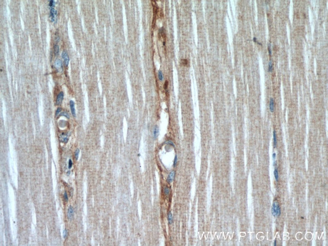 AMOT Antibody in Immunohistochemistry (Paraffin) (IHC (P))