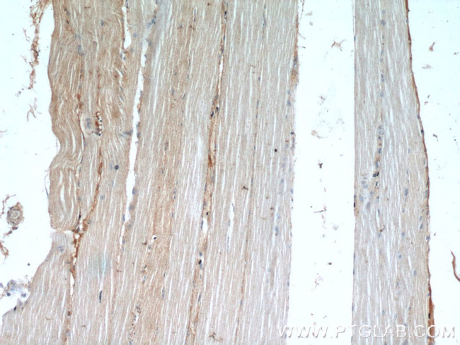 AMOT Antibody in Immunohistochemistry (Paraffin) (IHC (P))