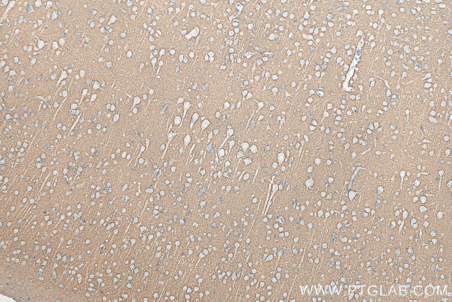 SNAP25 Antibody in Immunohistochemistry (Paraffin) (IHC (P))