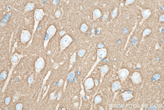 SNAP25 Antibody in Immunohistochemistry (Paraffin) (IHC (P))