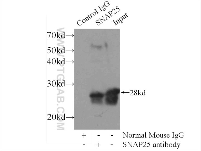 SNAP25 Antibody in Immunoprecipitation (IP)