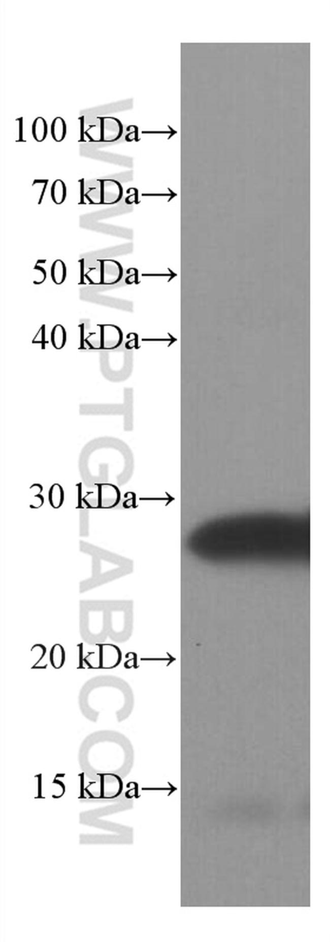 SNAP25 Antibody in Western Blot (WB)