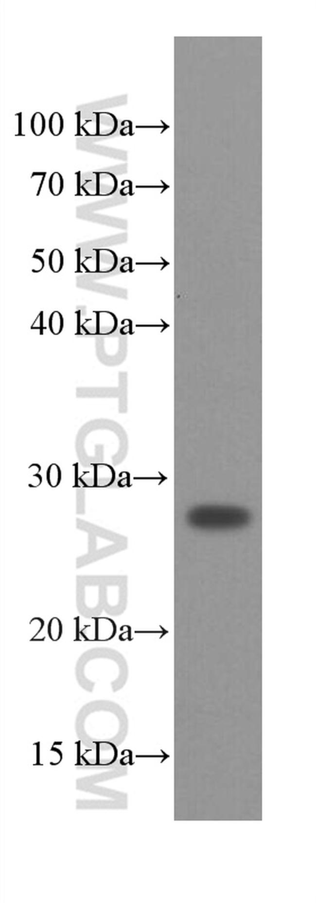 SNAP25 Antibody in Western Blot (WB)