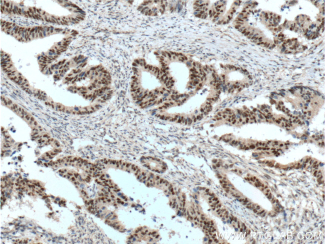 MSH2 Antibody in Immunohistochemistry (Paraffin) (IHC (P))