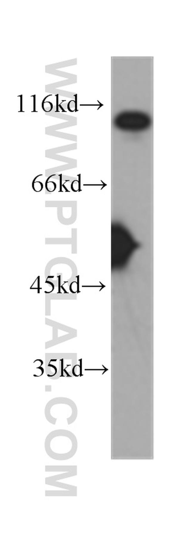 MSH2 Antibody in Western Blot (WB)