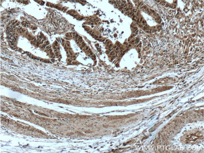 MSH2 Antibody in Immunohistochemistry (Paraffin) (IHC (P))