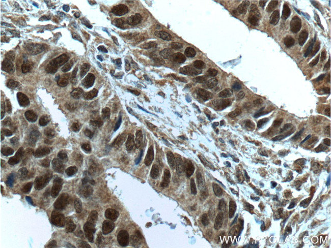 MSH2 Antibody in Immunohistochemistry (Paraffin) (IHC (P))