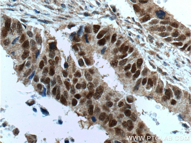 MSH2 Antibody in Immunohistochemistry (Paraffin) (IHC (P))