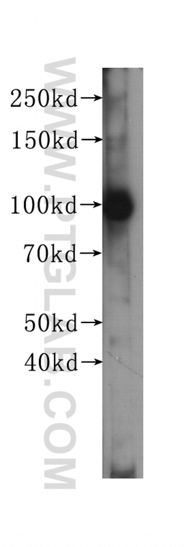 MSH2 Antibody in Western Blot (WB)