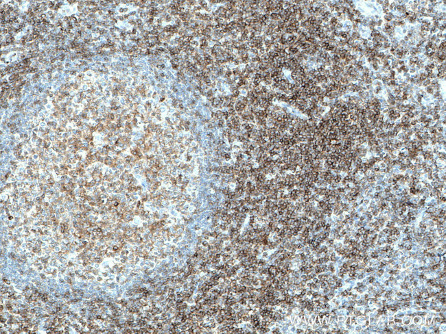 LCK Antibody in Immunohistochemistry (Paraffin) (IHC (P))