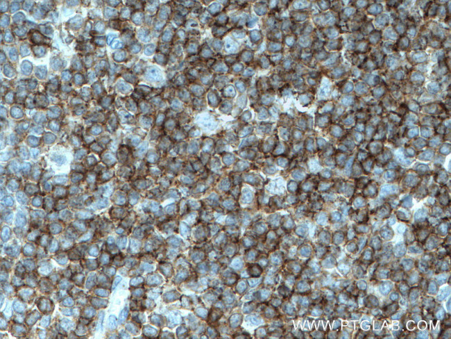 LCK Antibody in Immunohistochemistry (Paraffin) (IHC (P))