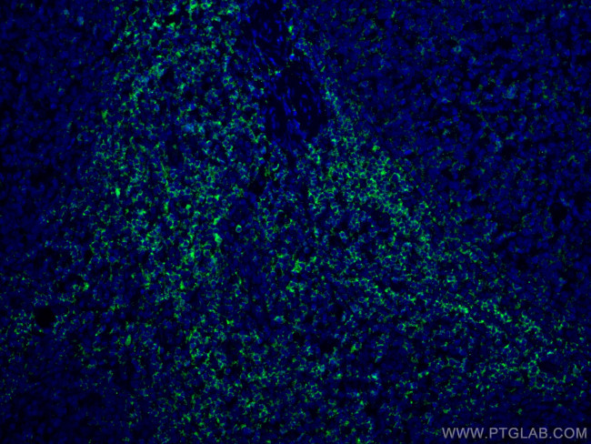 LCK Antibody in Immunohistochemistry (PFA fixed) (IHC (PFA))