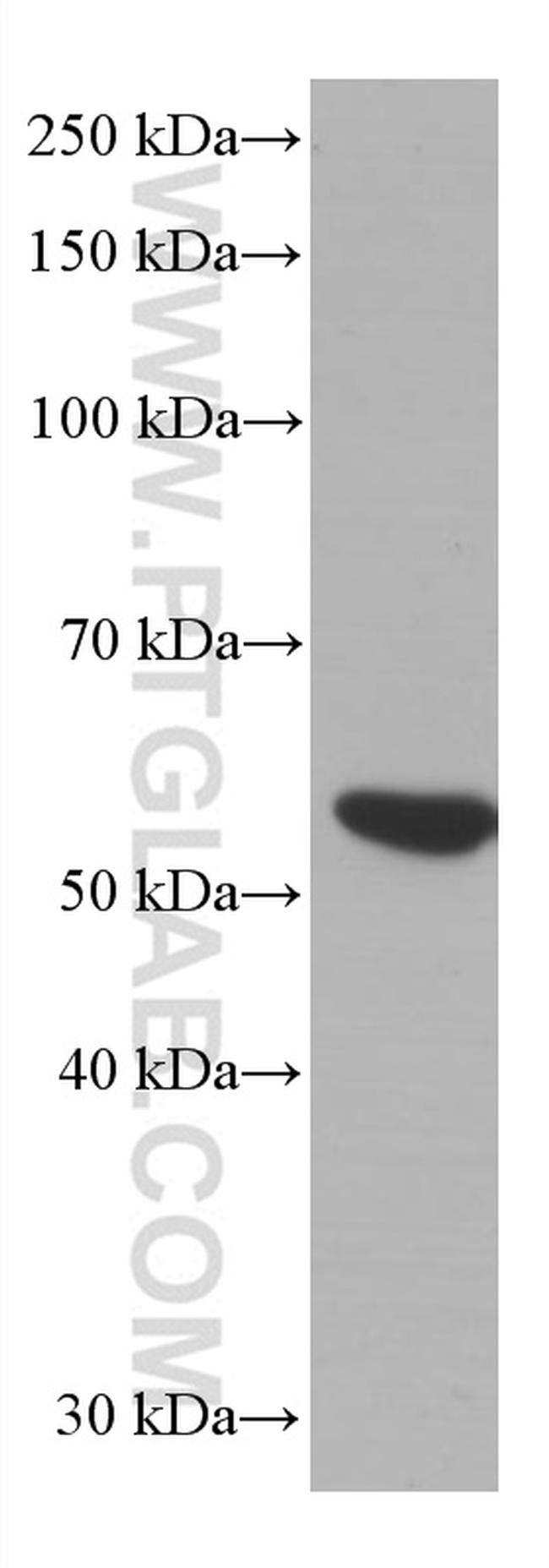 LCK Antibody in Western Blot (WB)