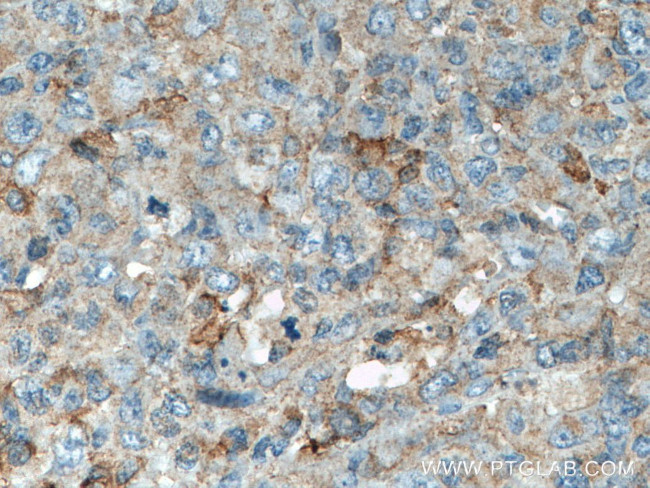 LCK Antibody in Immunohistochemistry (Paraffin) (IHC (P))