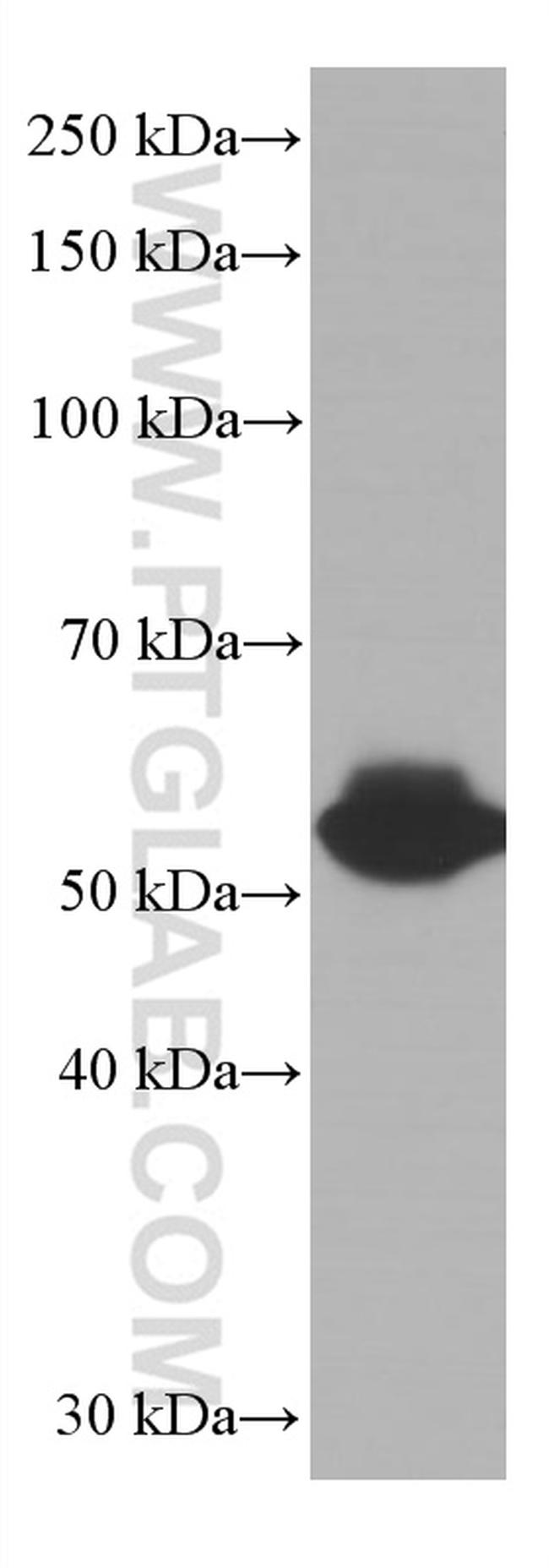 LCK Antibody in Western Blot (WB)