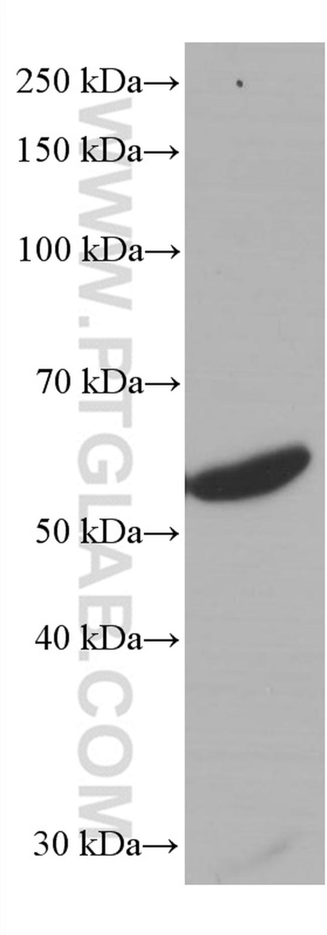 LCK Antibody in Western Blot (WB)