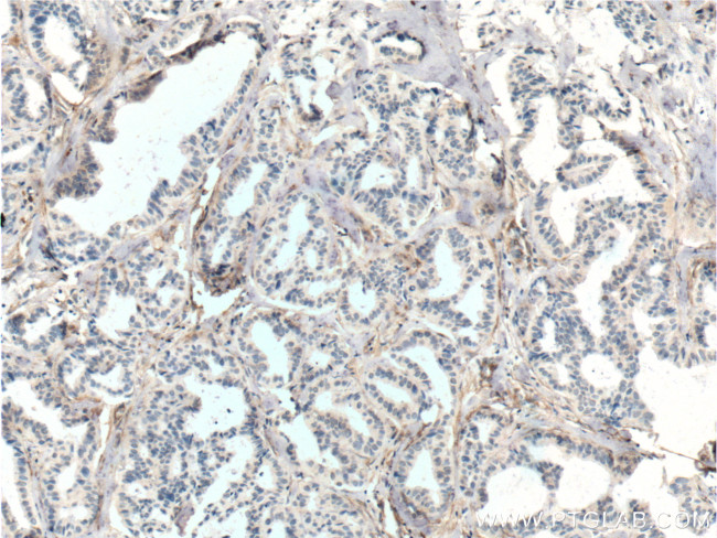 TEM1 Antibody in Immunohistochemistry (Paraffin) (IHC (P))