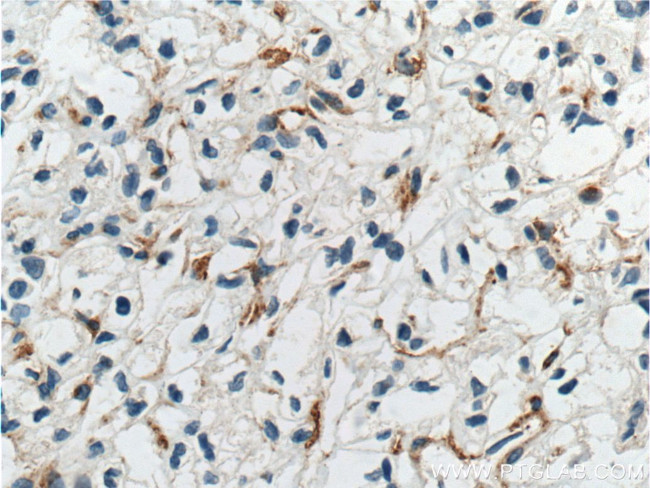 TEM1 Antibody in Immunohistochemistry (Paraffin) (IHC (P))