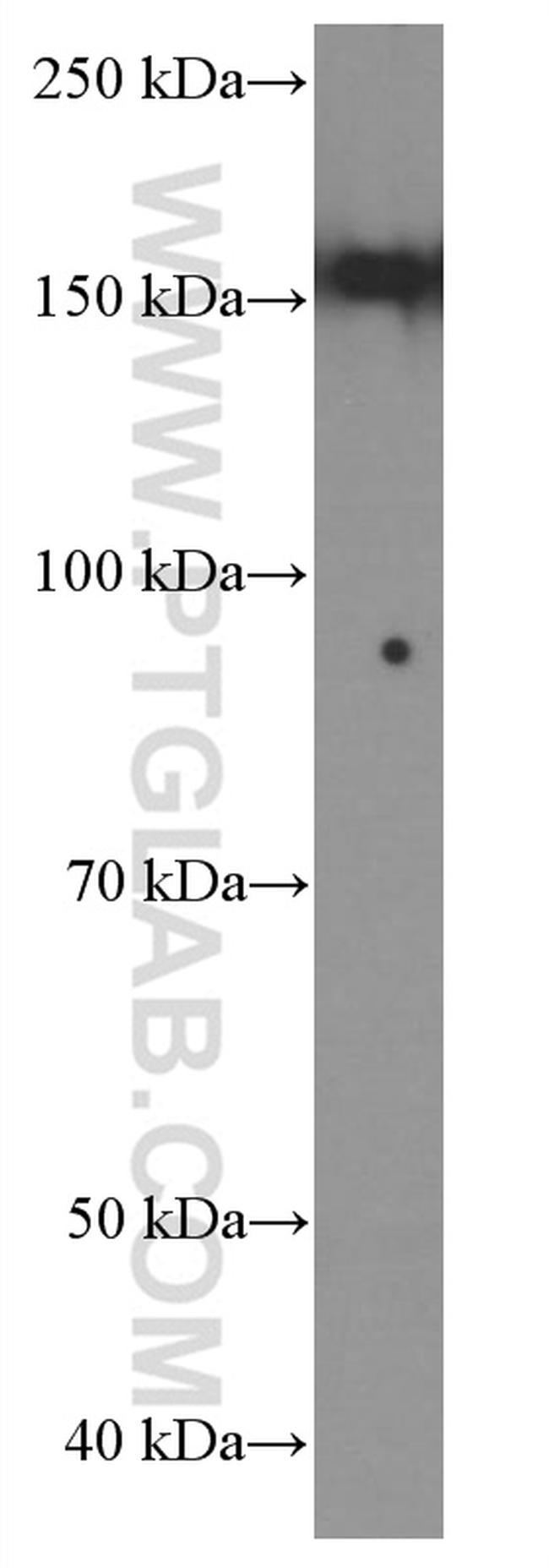 TEM1 Antibody in Western Blot (WB)