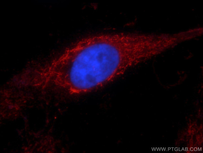 ALDH1A1 Antibody in Immunocytochemistry (ICC/IF)