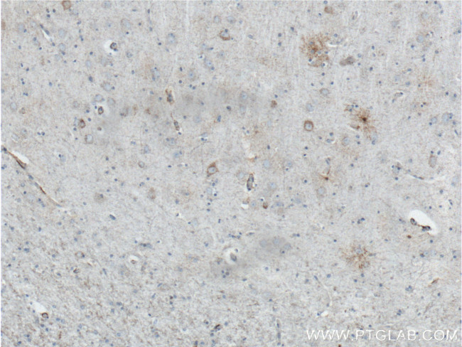 ALDH1A1 Antibody in Immunohistochemistry (Paraffin) (IHC (P))